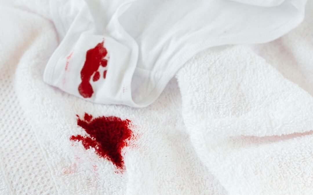 Why Red Wine, Coffee and Blood Need Different Carpet Stain Treatments