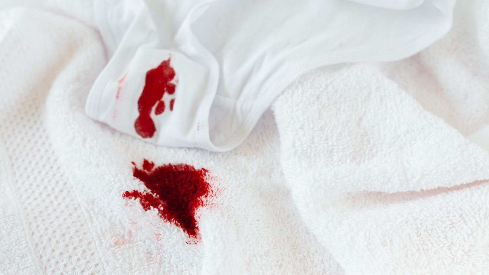 Red wine stain on a white cloth being treated